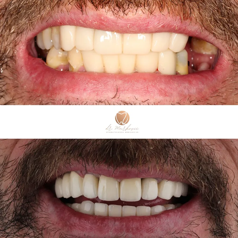 Transformacija osmijeha – fotografija 3